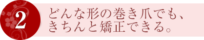 2 どんな形の巻き爪でも、きちんと矯正できる。